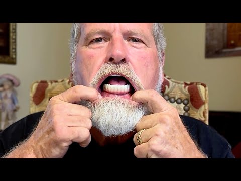 My 3 Regrets about Full Dental Implants after a Year