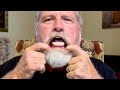 My 3 Regrets about Full Dental Implants after a Year