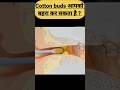 Cotton Buds से आपके कान का पर्दा फट सकता है जि�