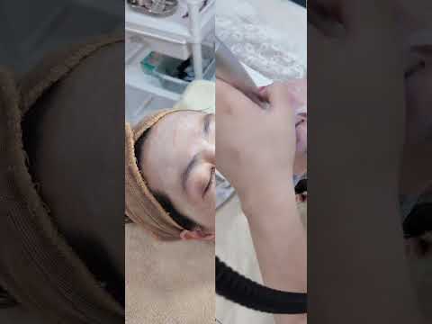 Liệu trình Peel da