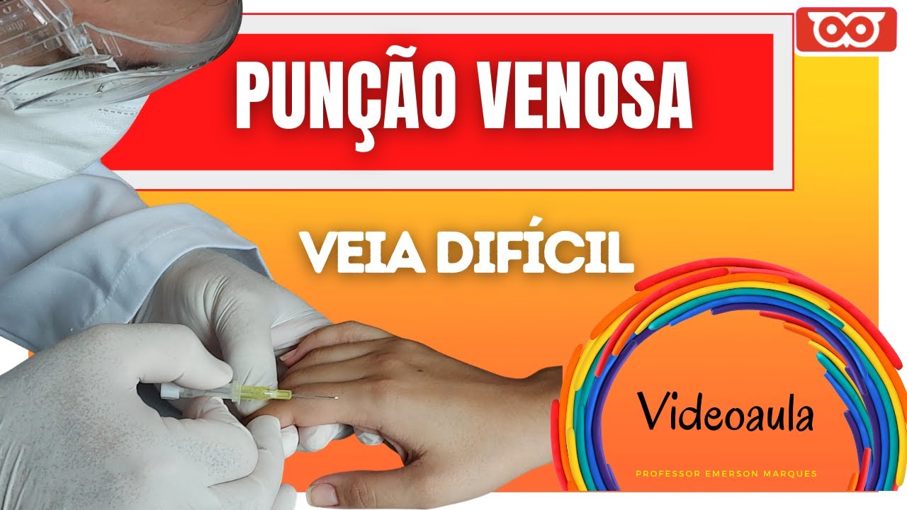 Punção Venosa VEIA DIFÍCIL