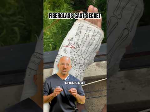 Cast Tip for a Better Broken Bone Experience #shorts