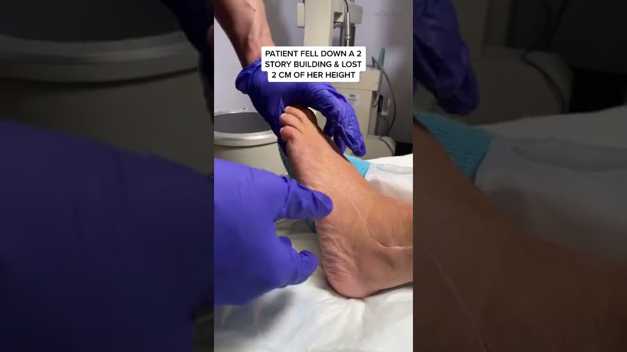 The Patient's Story: How Heel Lengthening helps pain