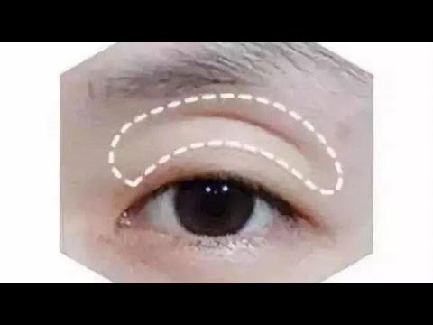 眼窩深面相