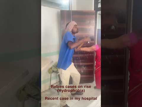 Dog bite cases on rise #dogbite #healthvideos #rabies #virus #vaccine #hydrophobia