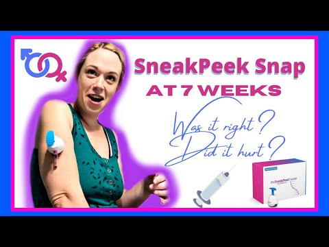 SNEAK PEEK SNAP EARLY GENDER BLOOD TEST| Full Review | Was it right? Did it hurt? 💉🩸🤰🏼