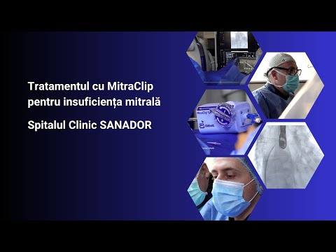 Tratamentul cu MitraClip pentru insuficiența mitrală – Spitalul Clinic SANADOR