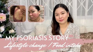 [Eng] My Psoriasis Story | How I Manage My Flare Ups | #Psoriasis Diet
