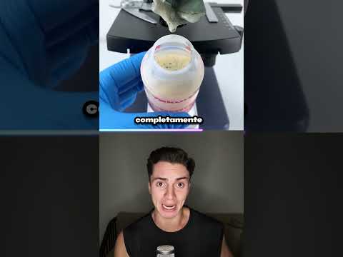 É ISSO QUE ACONTECE QUANDO VOCÊ BEBE YAKULT ESTRAGADO