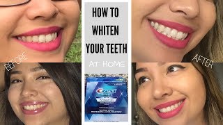 CREST 3D WHITESTRIPS | IT REALLY WORKS!!