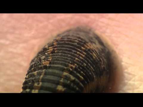 Shape of Life: Annelids - Leeches