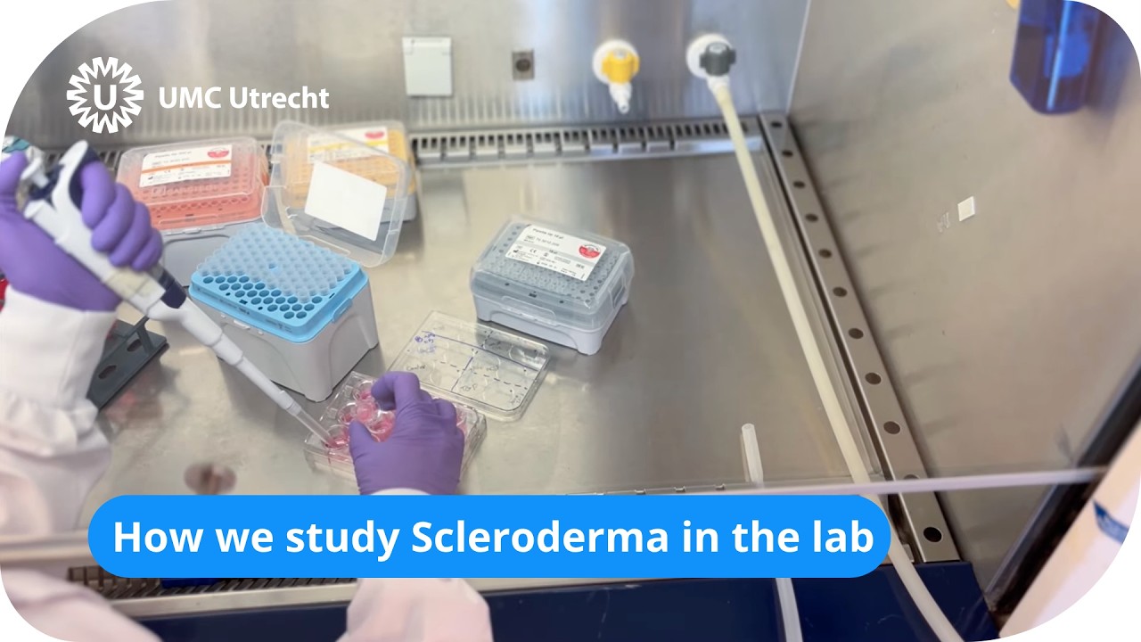 Videopitch I&I (Sara): From disease to discovery: How we study Scleroderma in the lab | UMC Utrecht