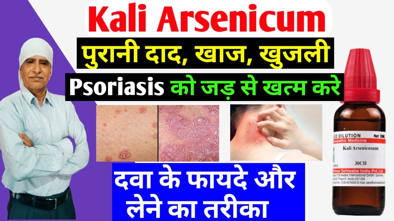 Kali Arsenicum 30 | kali arsenicum 200 | kali arsenicum homeopathy | kali arsenicum uses & benefits
