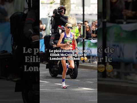 Les pieds en sang de Eilish McColgan sur le marathon de Londres ! 🚀🩸