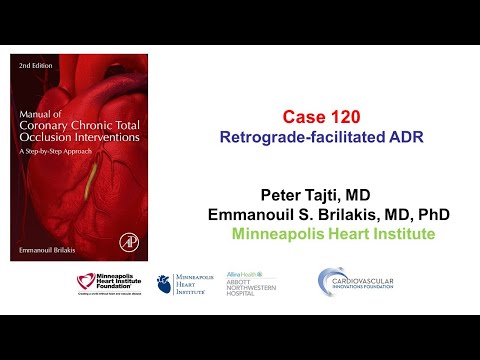 Case 120: Manual of CTO Interventions: Retrograde-facilitated ADR