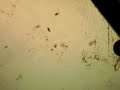 New Variant of RIfe Machine Technology Kills Paramecium in seconds!