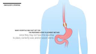 Peak Gastroenterology Associates