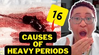 🤔Heavy Flow During Periods Means? | 16 CAUSES