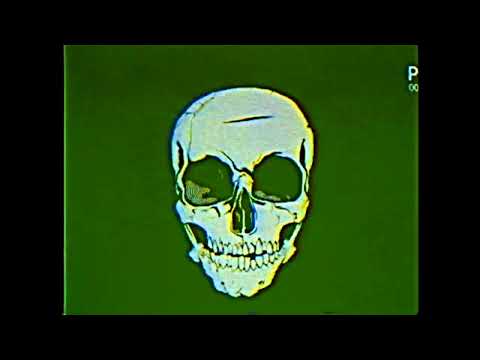 Chlubys x Esko - Okovy