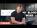 My Bloodwork AFTER Using Anabolics For The Last 3 Years | TTIN Ep 15
