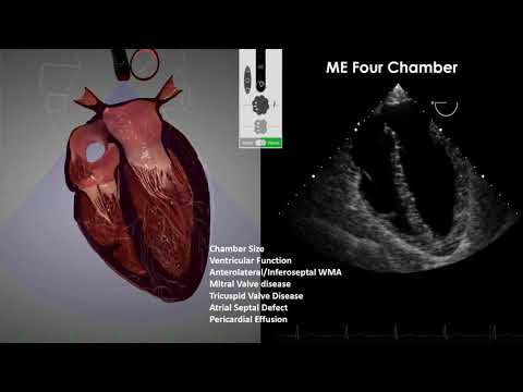 Transesophageal Echocardiography (TEE) Imaging