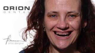 Caso del Dr. Federico Brunner