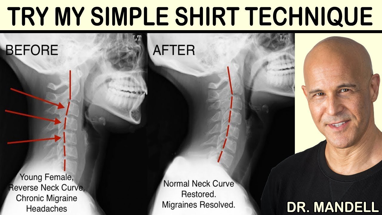 RESTORE YOUR BAD NECK CURVE WHILE LAYING IN BED - Dr Alan Mandell, DC - YouTube
