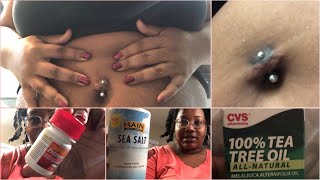 My Belly Piercing is Inflamed😢 How I Heal Belly Piercing Inflammation Overnight | Vlogtober Day 4