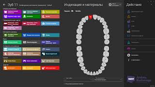 проверка активации модуля JAW MOTION IMPORT в exocad 3.0 и 3.1