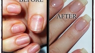 My Nail Journey-Growing Natural Nails after damage from Acrylics/Gels