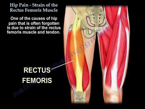 Hip Pain -Strain of the Rectus Femoris Muscle