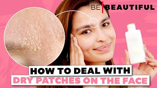 How to Remove Dry Patches From Your Face | Tips to Deal with Dry Skin | Be Beautiful