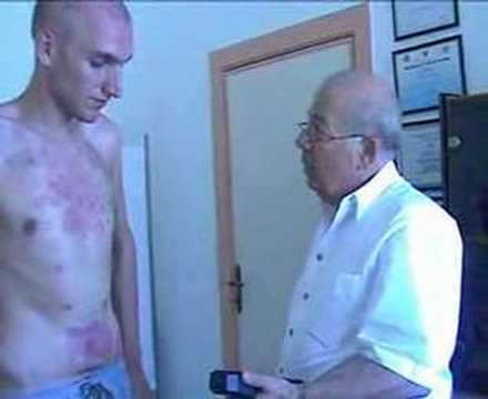 Das Ekzem auf den Ohren als zu behandeln Das Foto des Ekzems auf den Genitalien