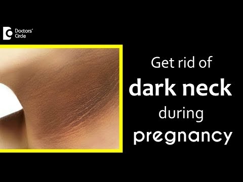 Remedy for pigmentation on neck during pregnancy - Dr. Rajdeep Mysore