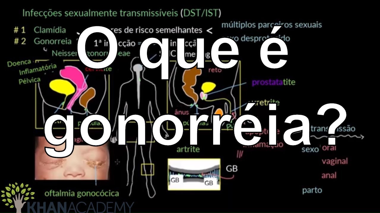 O que é gonorréia? | Vida e evolução | Khan Academy