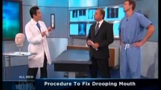 The Doctors - Dr. Youn Presents The Grin Lift (Corner Mouth Lift)