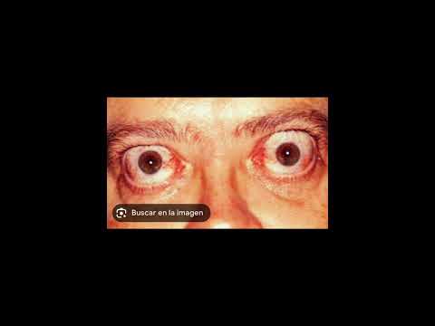 DILON BABY ❌ PINKY 92 - ALAGAYA 📿