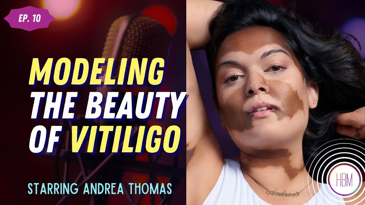 Episode 10: Andrea Thomas - Modeling The Beauty of Vitiligo