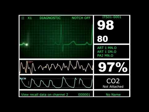Кардиомонитор | Пульс | Ритма сердечного слежение