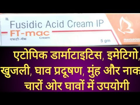 FT-mac Cream  Hindi use in atopic,exema  dermatitis,imigo