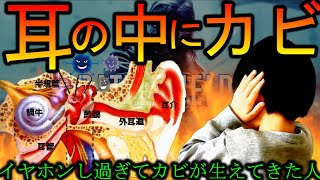 【閲覧注意】イヤホンし過ぎて耳の中にカビが生えてきた人【BF5】