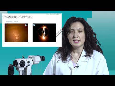 1 Adaptación de Lentes de Contacto Blandas Tóricas