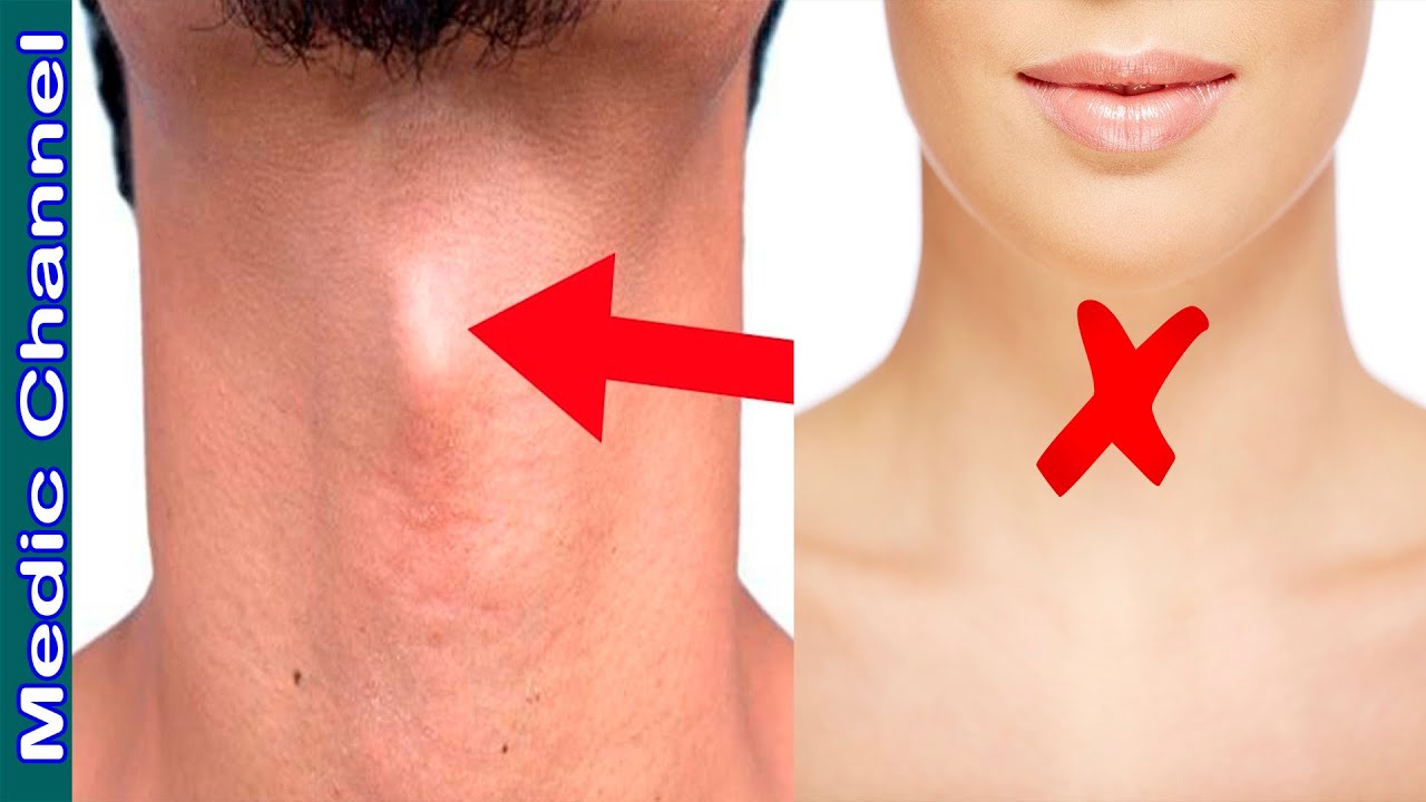 ¿Por qué los hombres tienen una manzana de Adán y las mujeres no