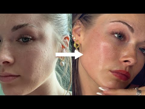 Glycolic Acid 7% Exfoliating Toner