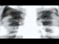 TV3 Denmark 24 Live Another Day Promo 2014