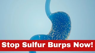 Transform Your Tummy: How to Get Rid of Sulfur Burps Today!