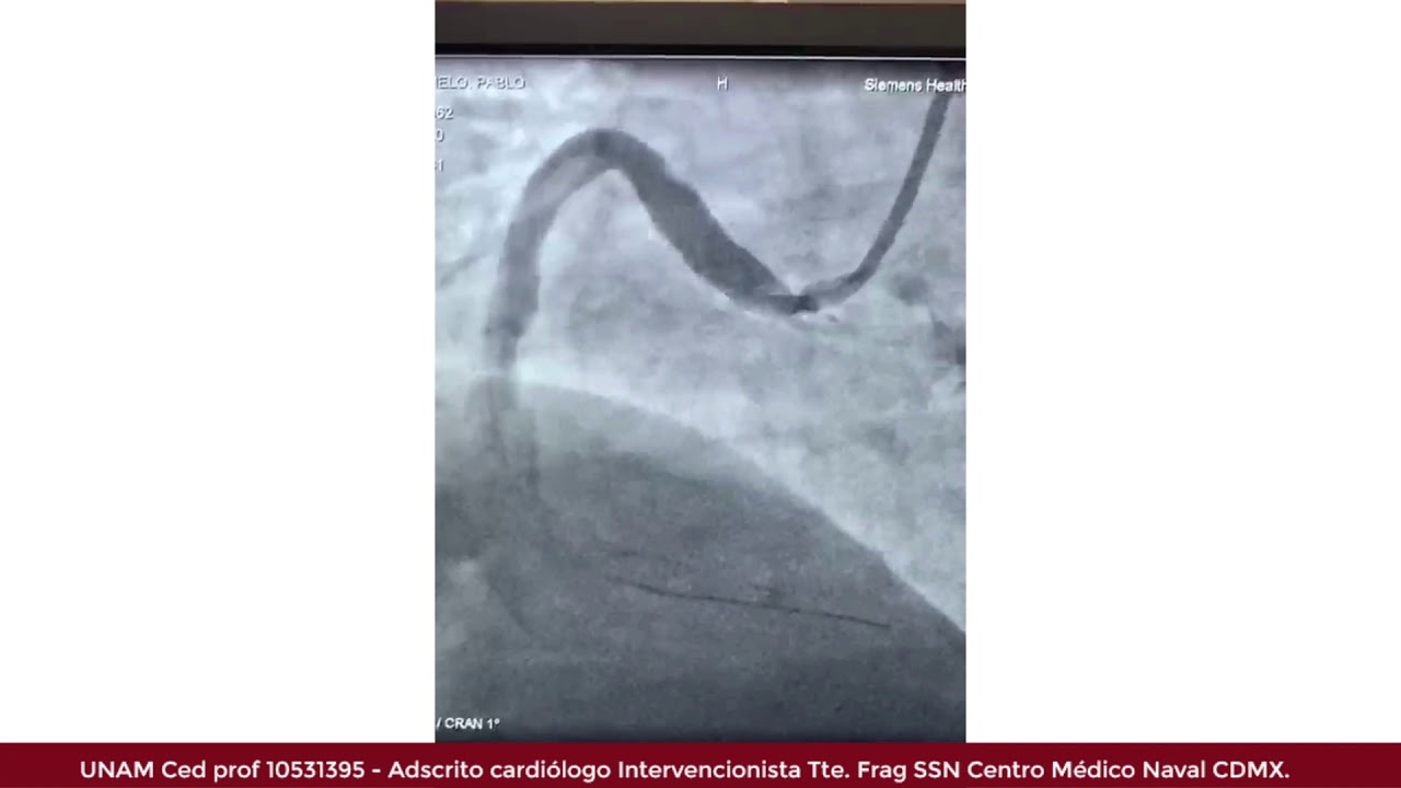 Marcelo Utrera Lagunas-102