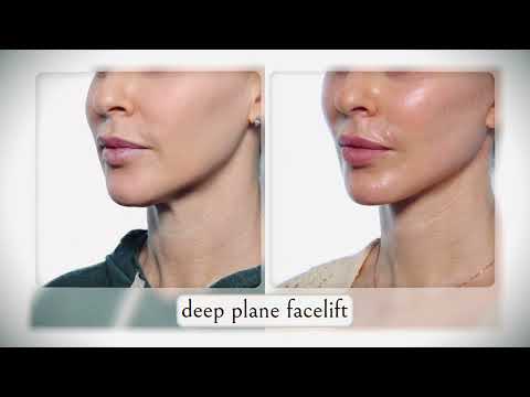 Unveiling the Deep Plane Facelift — Dr. Jonathan Zelken