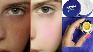 NIVEA से बनाइए Fairness &amp; Dark Spots Removal DAY Cream |Get spotless and fair skin | RABIA SKIN CARE