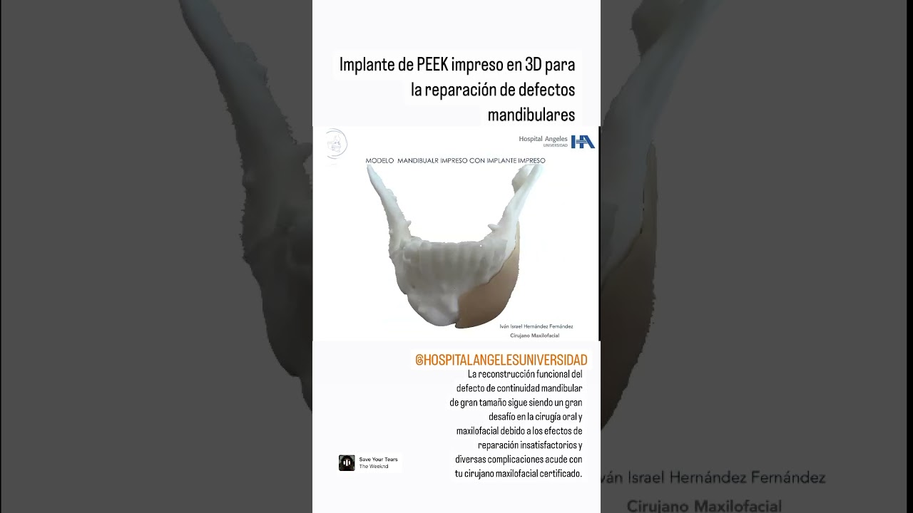 Ivan Israel Hernandez Fernandez-60